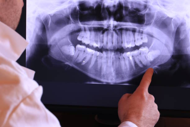 Best Emergency Dentist for Special Needs Patients in Monson Center, MA