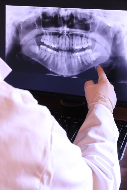 Best Emergency Dentist for Knocked-Out Tooth in Monson Center, MA