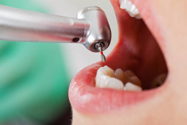 Best Emergency Cosmetic Dentistry in Monson Center, MA
